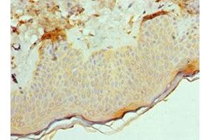 Immunohistochemistry of paraffin-embedded human skin tissue using ABIN7143181 at dilution of 1:100 (ACVR2A anticorps  (AA 20-140))