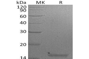 Western Blotting (WB) image for Interleukin 21 (IL21) protein (ABIN7320585) (IL-21 Protéine)