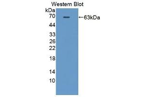 Western blot analysis of the recombinant protein. (HCK anticorps  (AA 2-524))