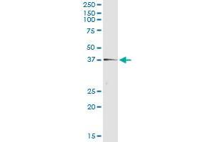 Immunoprecipitation of TEX264 transfected lysate using anti-TEX264 monoclonal antibody and Protein A Magnetic Bead , and immunoblotted with TEX264 MaxPab rabbit polyclonal antibody. (TEX264 anticorps  (AA 1-313))
