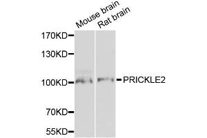 Western blot analysis of extracts of various cell lines, using PRICKLE2 antibody. (PRICKLE2 anticorps)