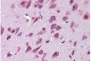 Mouse brain: Formalin-Fixed, Paraffin-Embedded (FFPE)