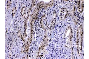 IHC analysis of MED15 using anti-MED15 antibody .