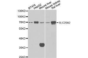 Western blot analysis of extracts of various cell lines, using SLC20A2 antibody (ABIN5974076) at 1/1000 dilution. (SLC20A2 anticorps)