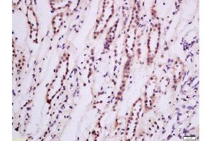 Formalin-fixed and paraffin embedded Human kidney tissue labeled with Anti-PKC epsilon Polyclonal Antibody, Unconjugated 1:200 followed by conjugation to the secondary antibody and DAB staining (PKC epsilon anticorps  (AA 631-737))