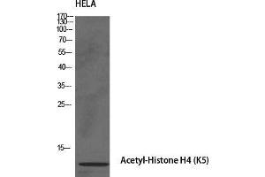 Western Blot (WB) analysis of specific cells using Acetyl-Histone H4 (K5) Polyclonal Antibody. (Histone H4 anticorps  (acLys5))