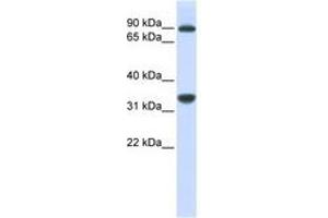 Image no. 1 for anti-Ribosomal RNA Processing 1 Homolog B (RRP1B) (AA 684-733) antibody (ABIN6740938) (RRP1B anticorps  (AA 684-733))