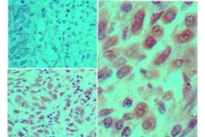 IKK alpha Immunohistochemistry.