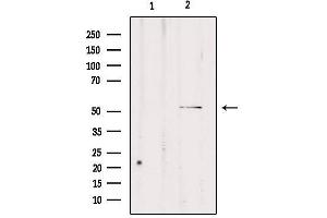 Western blot analysis of extracts from rat brain, using CPE Antibody.