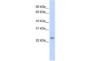 WB Suggested Anti-RAB8A Antibody Titration:  0. (RAB8A anticorps  (Middle Region))