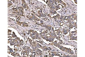 IHC analysis of LSR using anti-LSR antibody (ABIN7599514).