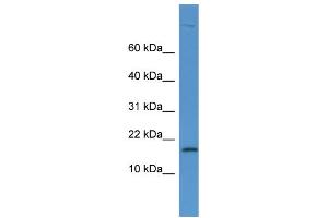 Western Blotting (WB) image for anti-Lysozyme (LYZ) (N-Term) antibody (ABIN2788395)