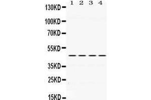 Western Blotting (WB) image for anti-Paired Box 6 (PAX6) (AA 195-233), (Middle Region) antibody (ABIN3043379) (PAX6 anticorps  (Middle Region))