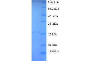 SDS-PAGE (SDS) image for Major Histocompatibility Complex, Class II, DP alpha 1 (HLA-DPA1) (AA 29-222), (Extracellular) protein (His tag) (ABIN5712942)
