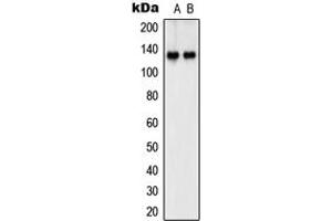 Western blot analysis of SHANK2 expression in Jurkat (A), IMR32 (B) whole cell lysates. (SHANK2 anticorps  (Center))