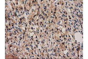 Image no. 8 for anti-Pyrroline-5-Carboxylate Reductase 3 (PYCRL) antibody (ABIN1500522)