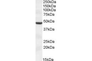 Western Blotting (WB) image for anti-Transmembrane Protease, serine 4 (TMPRSS4) (Internal Region) antibody (ABIN2464170) (TMPRSS4 anticorps  (Internal Region))