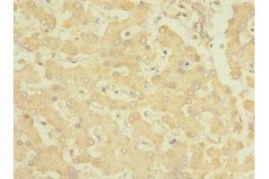 Immunohistochemistry of paraffin-embedded human liver tissue using ABIN7151868 at dilution of 1:100