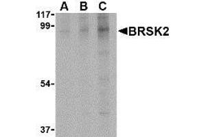 Western blot analysis of BRSK2 in human brain tissue lysate with AP30168PU-N BRSK2 antibody at (A) 0. (BRSK2 anticorps  (C-Term))