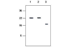 Western blot analysis: Human recombinant protein KIR2DL1, KIR2DL3 and KIR2DL4 (each 20ng per well) were resolved by SDS-PAGE, transferred to PVDF membrane and probed with anti-human KIR2DL4 (1:500). (KIR2D anticorps)