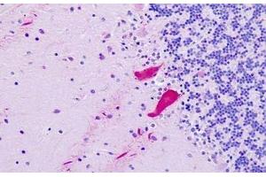 Human, Brain, Cerebellum: Formalin-Fixed Paraffin-Embedded (FFPE)