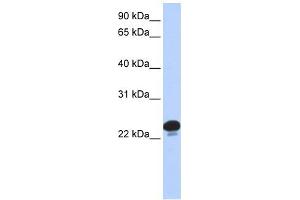 CAPS antibody used at 1 ug/ml to detect target protein. (Calcyphosine anticorps  (N-Term))