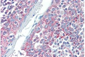 Human Tonsil (formalin-fixed, paraffin-embedded) stained with DIABLO antibody ABIN462354 followed by biotinylated anti-mouse IgG secondary antibody ABIN481714, alkaline phosphatase-streptavidin and chromogen.