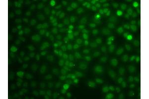 Immunofluorescence analysis of A549 cells using CBLC antibody (ABIN5975726). (CBLC anticorps)