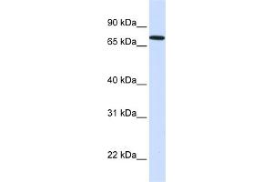 WB Suggested Anti-SETDB2 Antibody Titration:  0. (SETDB2 anticorps  (N-Term))