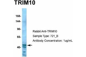 Host:  Rabbit  Target Name:  TRIM10  Sample Type:  Hela  Antibody Dilution:  1.