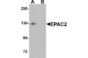 Western blot analysis of EPAC2 in rat liver tissue lysate with EPAC2 antibody at 1 µg/mL in (A) the absence and (B) the presence of blocking peptide. (RAPGEF4 anticorps  (N-Term))