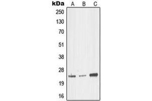 Western blot analysis of MED18 expression in HEK293T (A), mouse brain (B), rat kidney (C) whole cell lysates. (MED18 anticorps  (Center))