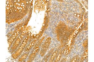 anti-Usher Syndrome 1C (Autosomal Recessive, Severe) (USH1C) (Internal Region) antibody