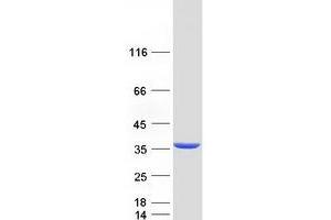 2,4-Dienoyl CoA Reductase 1, Mitochondrial (DECR1) protein (Myc-DYKDDDDK Tag)