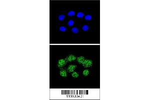Confocal immunofluorescent analysis of MSH2 Antibody with Hela cell followed by Alexa Fluor 488-conjugated goat anti-rabbit lgG (green).