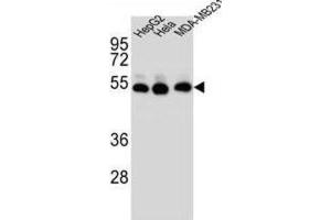 Western Blotting (WB) image for anti-Tubulin, beta 2B (TUBB2B) antibody (ABIN2996447)