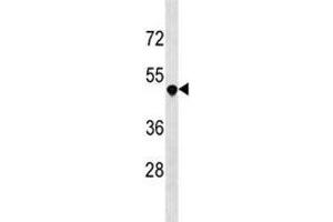 DR3 antibody western blot analysis in 293 lysate.