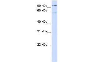 WB Suggested Anti-DLG7 Antibody Titration:  0. (DLGAP5 anticorps  (N-Term))