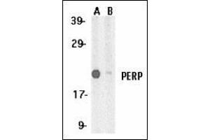Western blot analysis of PERP expression in A431 whole cell lysates in the absence (A) and presence (B) of blocking peptide with this product at 1 μg /ml. (PERP anticorps  (C-Term))