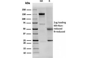 SDS-PAGE Analysis Purified Dystrophin Monospecific Mouse Monoclonal Antibody (DMD/3242).