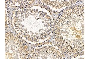ABIN6256903 and ABIN6275795 at 1/100 staining rat testis tissue by IHC-P. (ANAPC5 anticorps  (Internal Region))