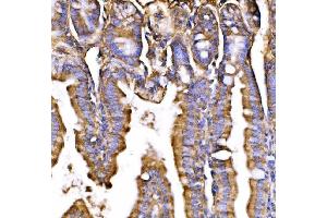 IHC analysis of GPR54/KISS1R using anti-GPR54/KISS1R antibody (ABIN7602153). (KISS1R anticorps  (AA 60-373))
