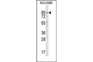 Image no. 1 for anti-Guanylate Cyclase 1, Soluble, alpha 2 (GUCY1A2) (C-Term) antibody (ABIN360707) (GUCY1A2 anticorps  (C-Term))