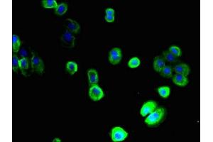 Immunofluorescent analysis of A431 cells using ABIN7170166 at dilution of 1:100 and Alexa Fluor 488-congugated AffiniPure Goat Anti-Rabbit IgG(H+L)