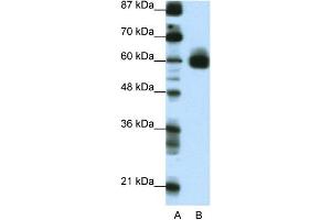WB Suggested Anti-CIR Antibody Titration:  0. (KCNJ5 anticorps  (C-Term))