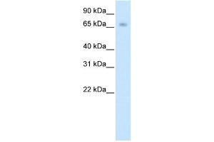 WB Suggested Anti-KBTBD10 Antibody Titration:  0.
