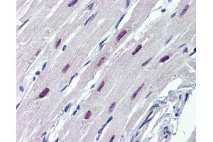 SOX4 antibody was used for immunohistochemistry at a concentration of 4-8 ug/ml.
