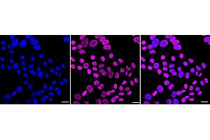 Immunocytochemical staining of HepG2 cells with Histone H4 (acetyl K5) antibody (ABIN7798979), 1:1,000). (Recombinant Histone H4 anticorps  (H4K5ac))