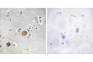 Peptide - +Immunohistochemistry analysis of paraffin-embedded human brain tissue using Catenin-α1 antibody. (CTNNA1 anticorps  (Internal Region))