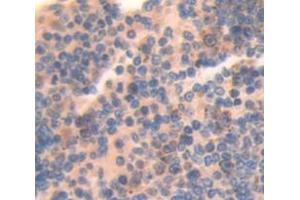 Figure. (CRLF1 anticorps  (AA 138-422))